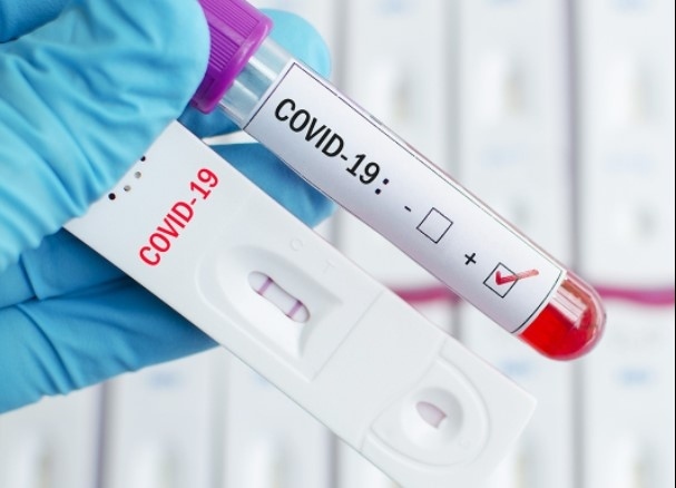 439 са новите случаи на коронавирус